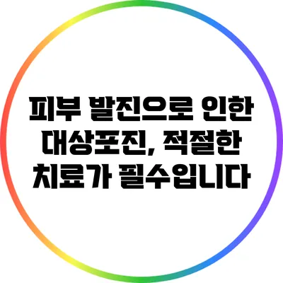 피부 발진으로 인한 대상포진, 적절한 치료가 필수입니다